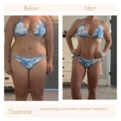 Before and After Gallery in Wilmington NC