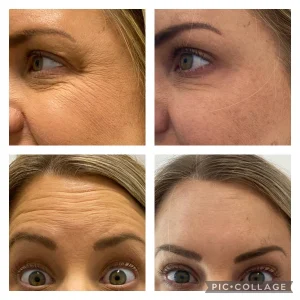 Before and After Gallery in Wilmington, NC