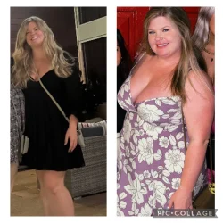 Before and After Treatment images in wilmington NC