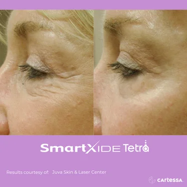 Before and After Gallery in beach Medical Aesthetics