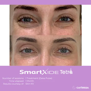 Before and After Gallery in beach Medical Aesthetics