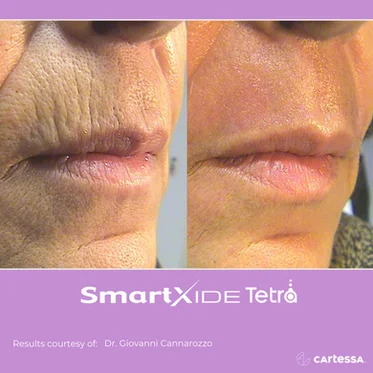 Before and After Gallery in beach Medical Aesthetics